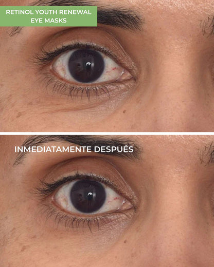 Pack Retinol Youth Renewal Eye Masks (5 Unidades)