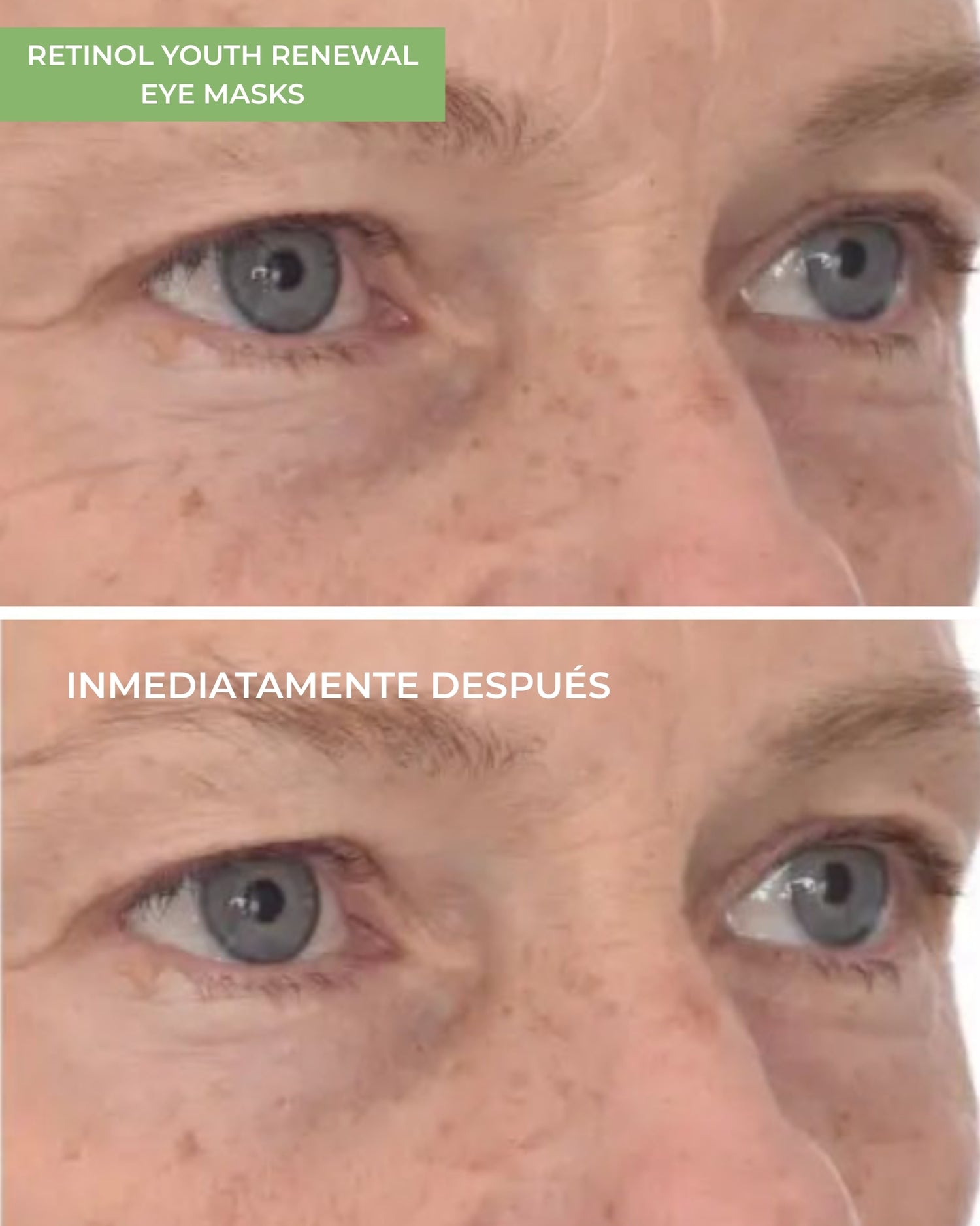 Pack Retinol Youth Renewal Eye Masks (5 Unidades)