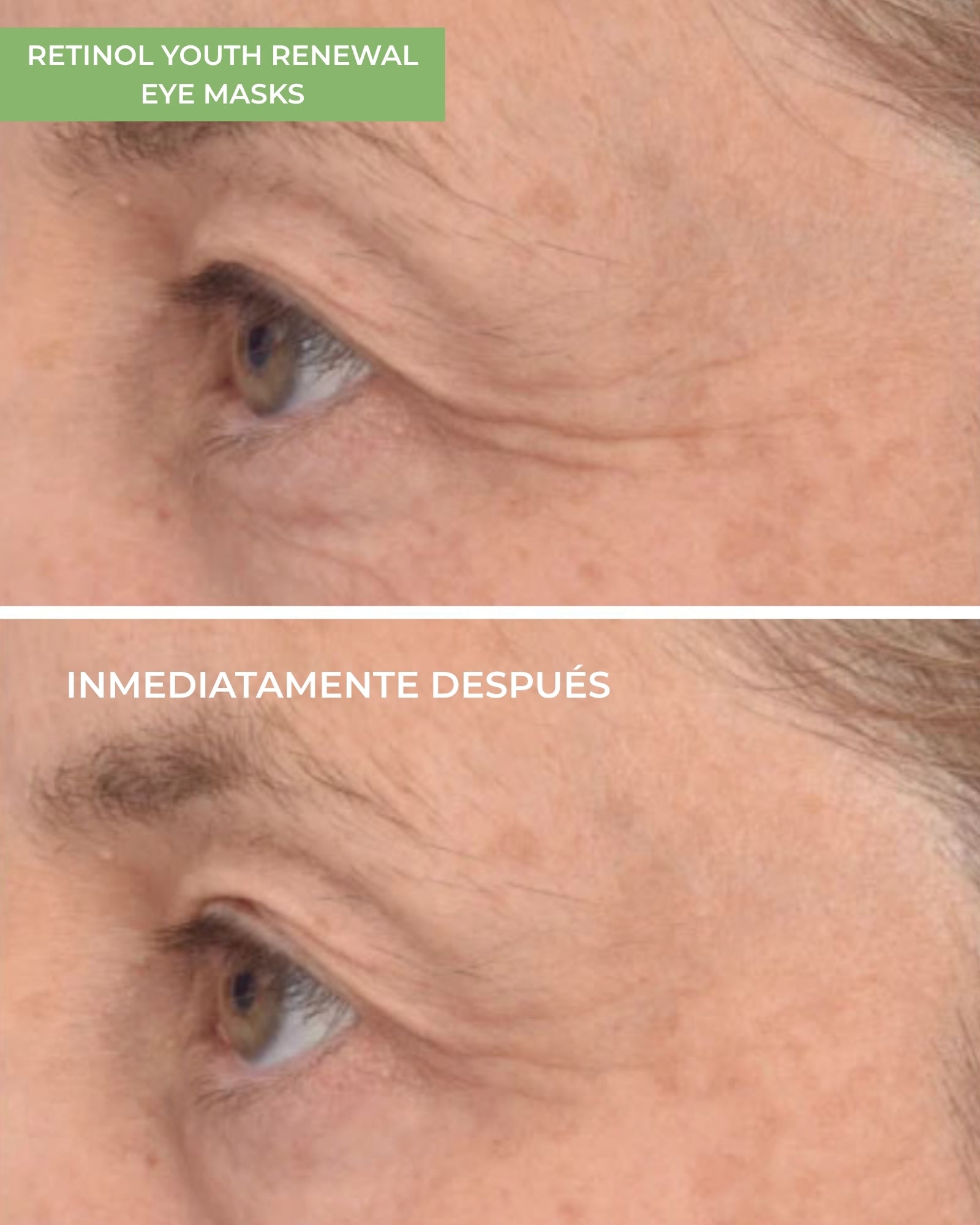 Pack Retinol Youth Renewal Eye Masks (5 Unidades)