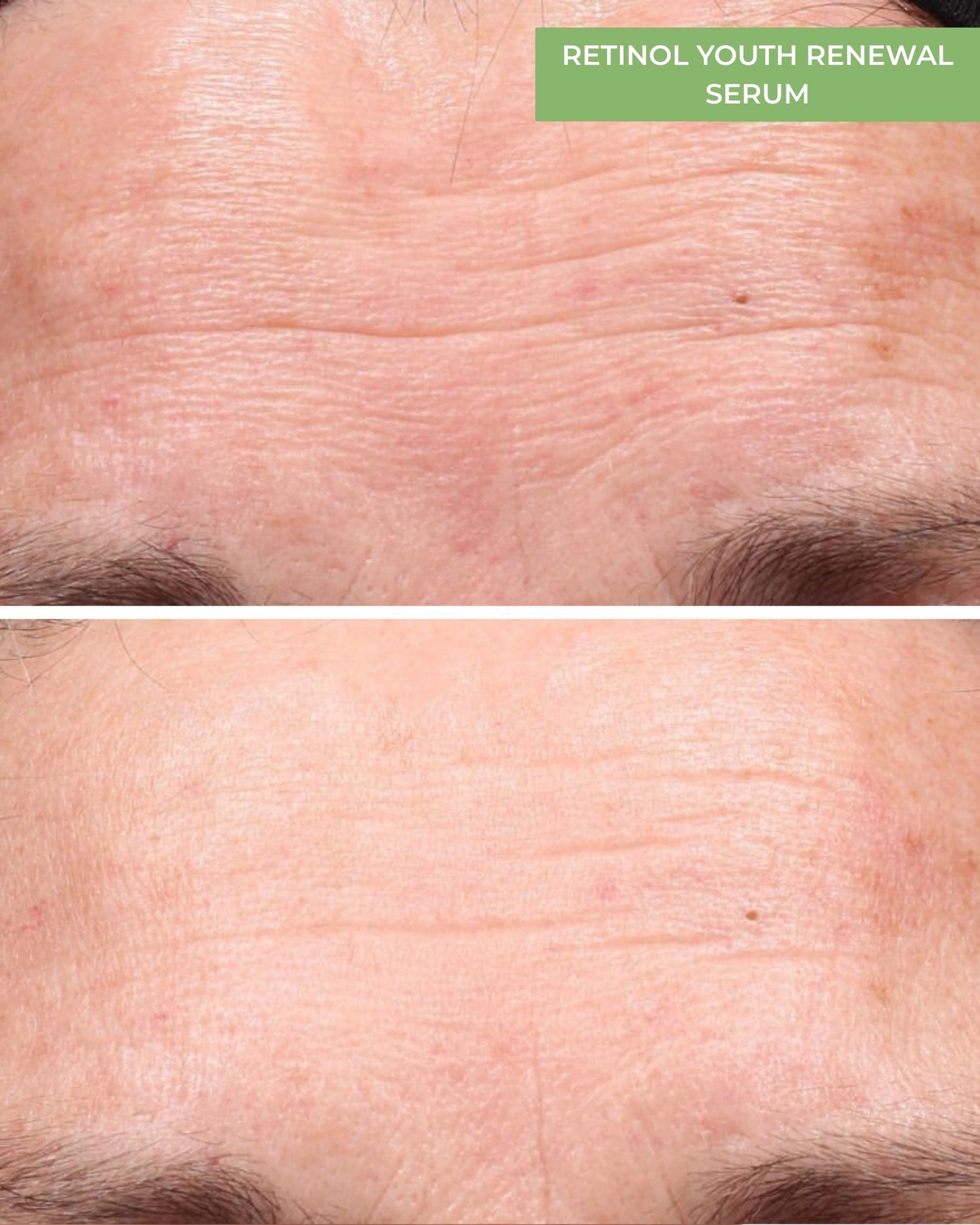Retinol Youth Renewal Serum
