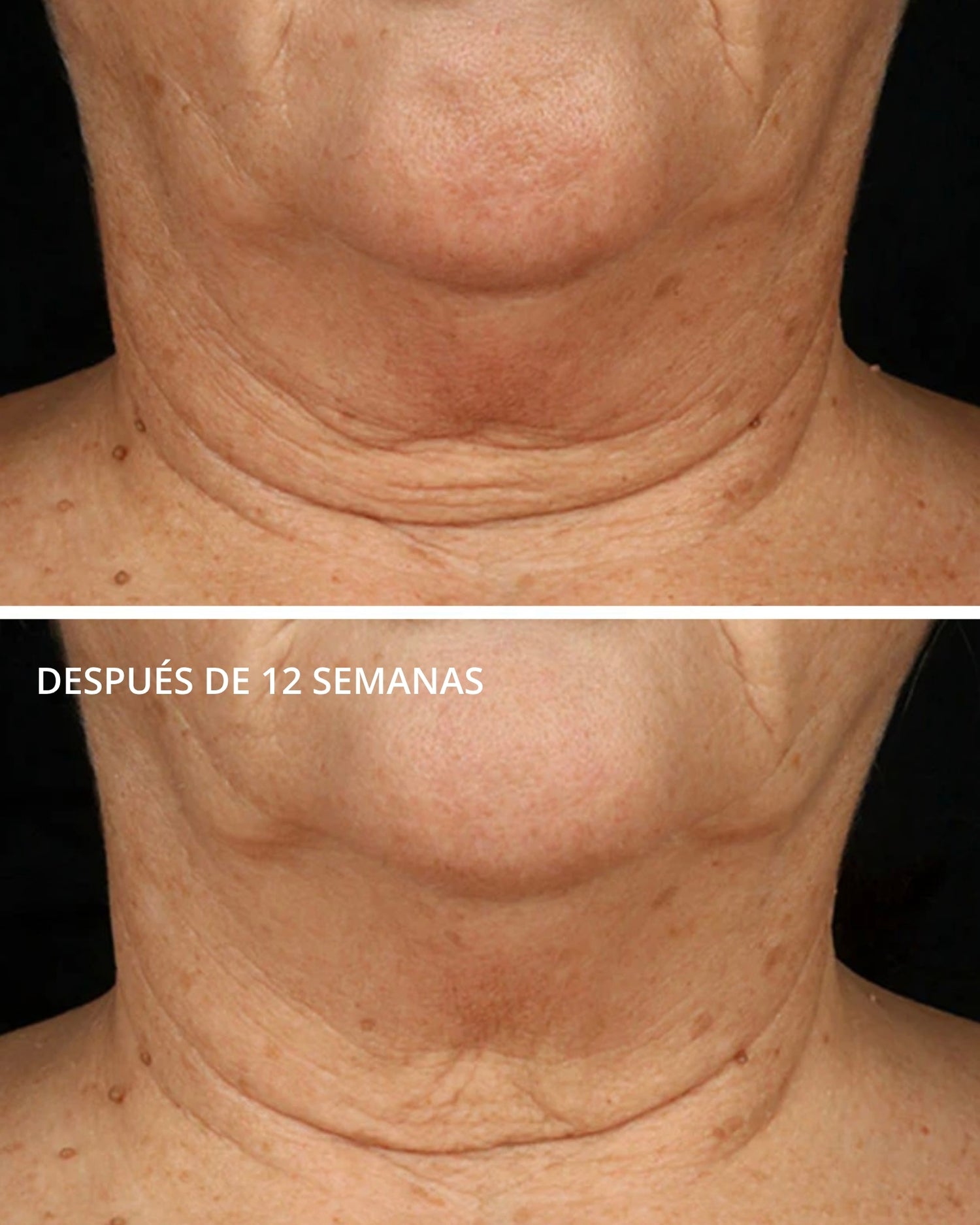 Triple Firming Neck Cream con MicroDiPéptido229® Neostrata