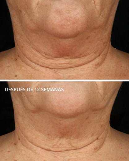 Triple Firming Neck Cream con MicroDiPéptido229® Neostrata