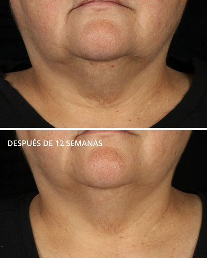 Tri-Therapy Lifting Serum con MicroDiPéptido229® Neostrata