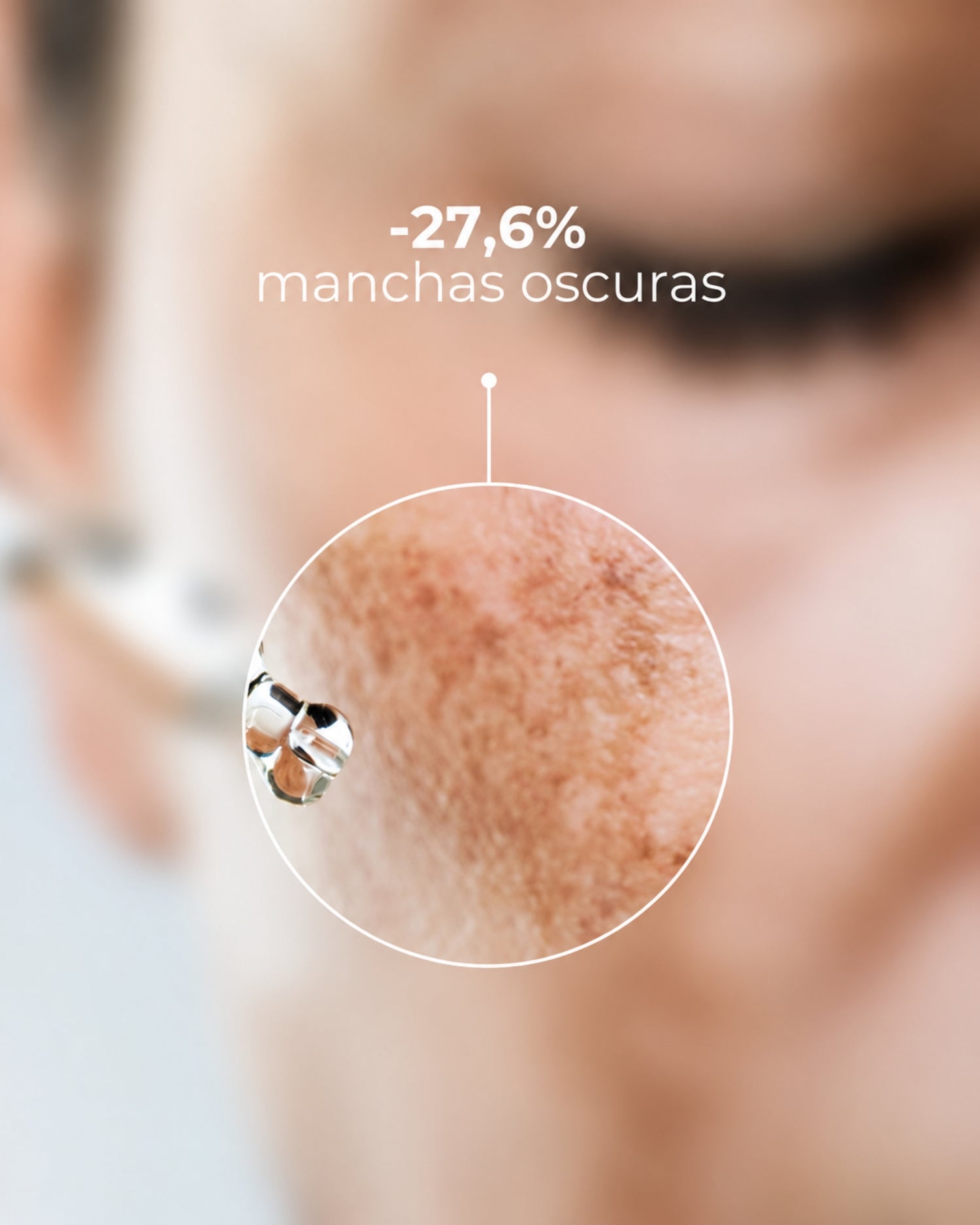 TXA Anti-Dark Spots Concentrate Despigmentante 1 Frasco x 10 ml DermEden