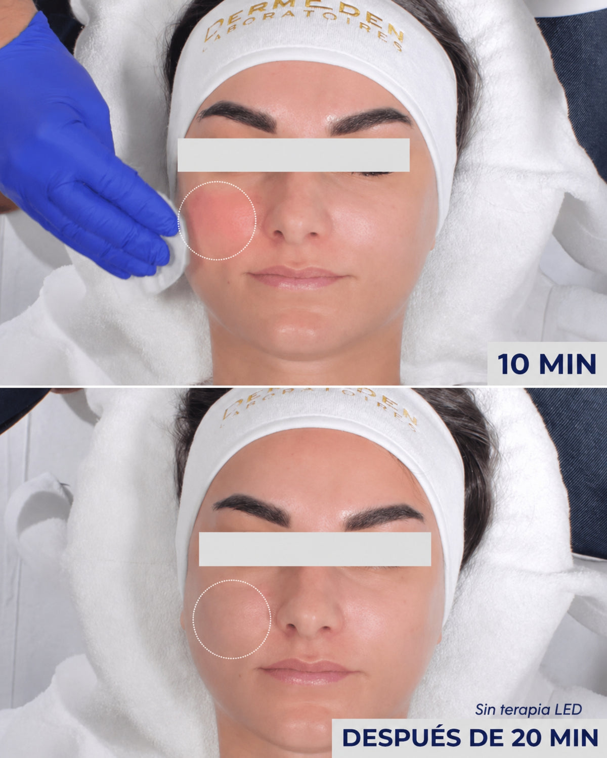 TXA Biocellulose Mask DermEden