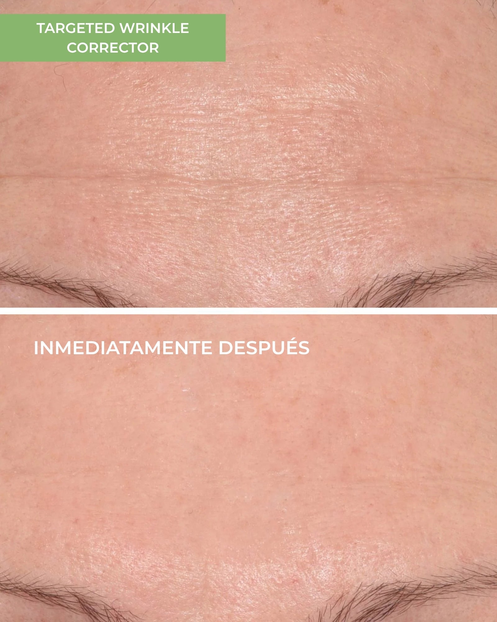 Targeted Wrinkle Corrector