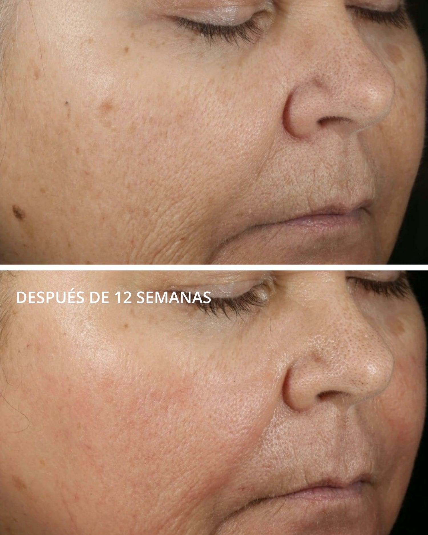Vitamina C 15% + PHA Serum Neostrata