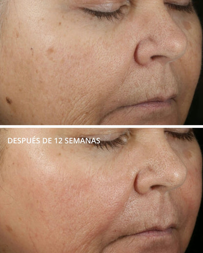 Vitamina C 15% + PHA Serum Neostrata
