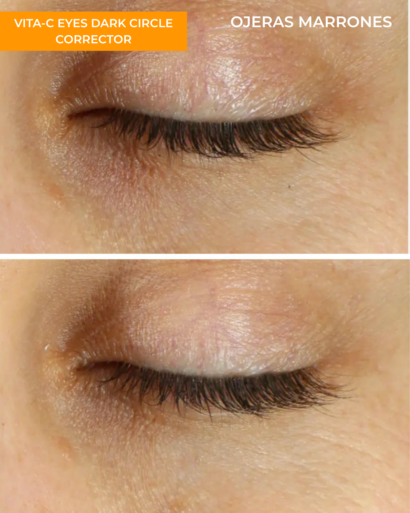 Vita-C Eyes Dark Circle Corrector