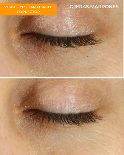 Vita-C Eyes Dark Circle Corrector