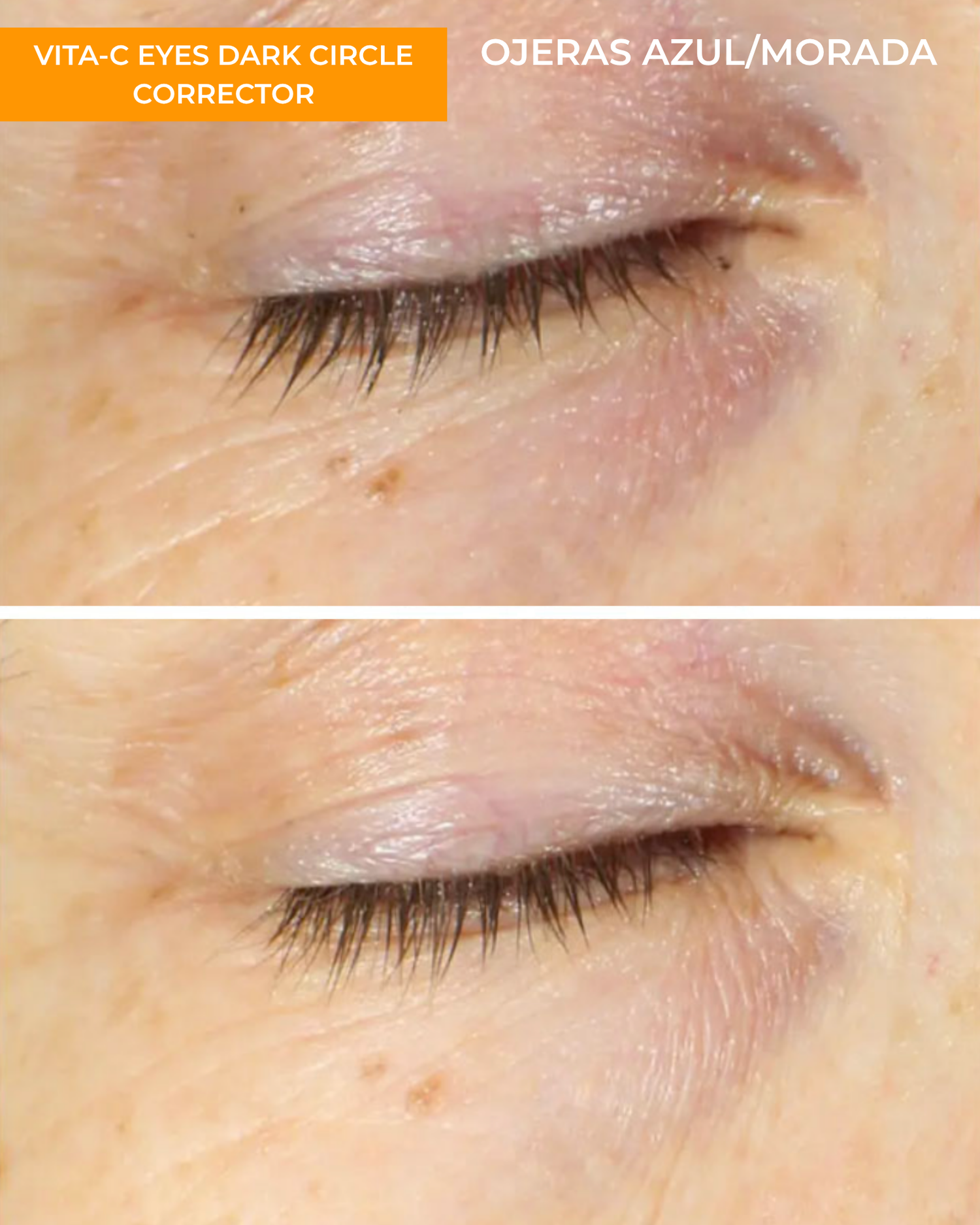 Vita-C Eyes Dark Circle Corrector