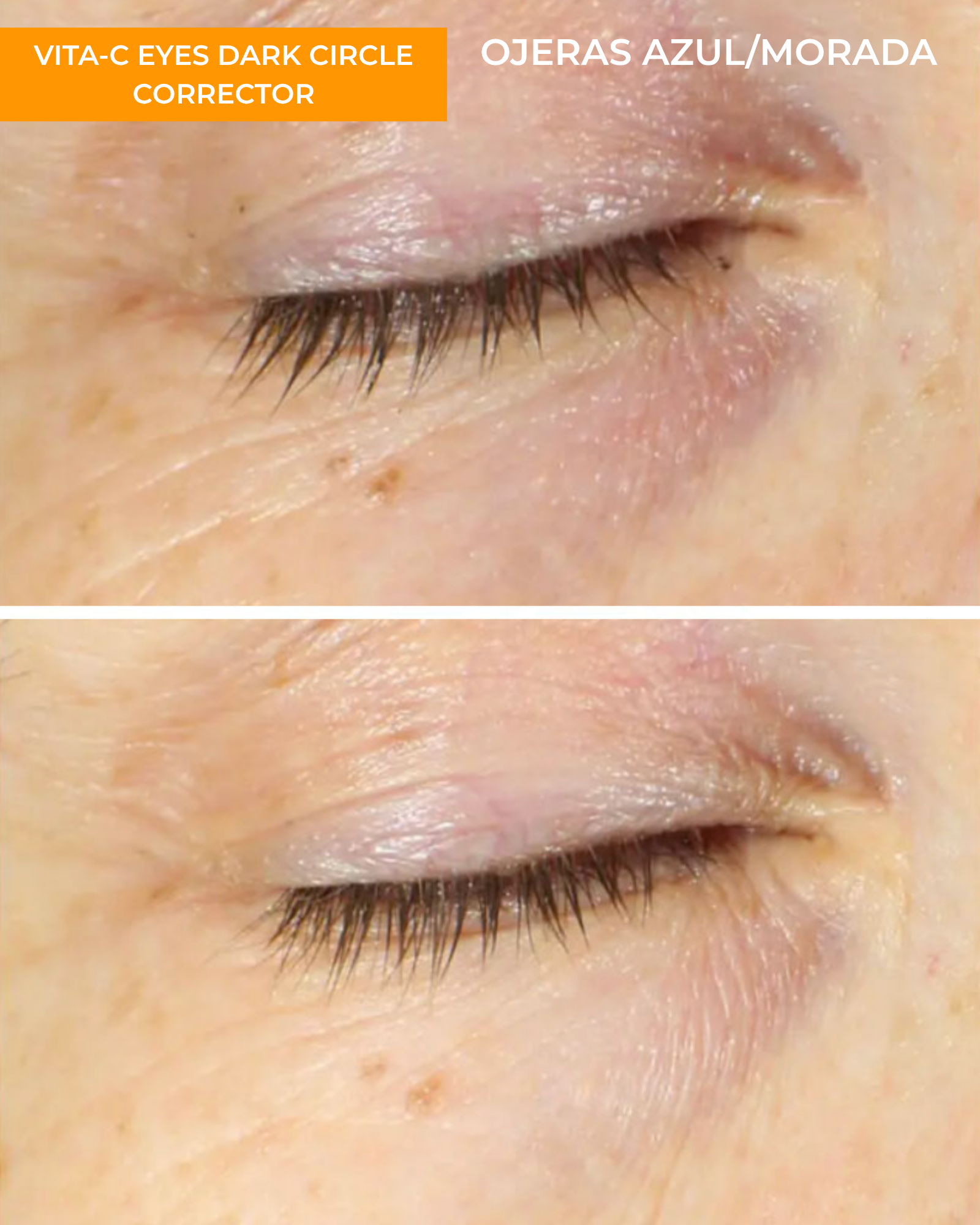 Vita-C Eyes Dark Circle Corrector