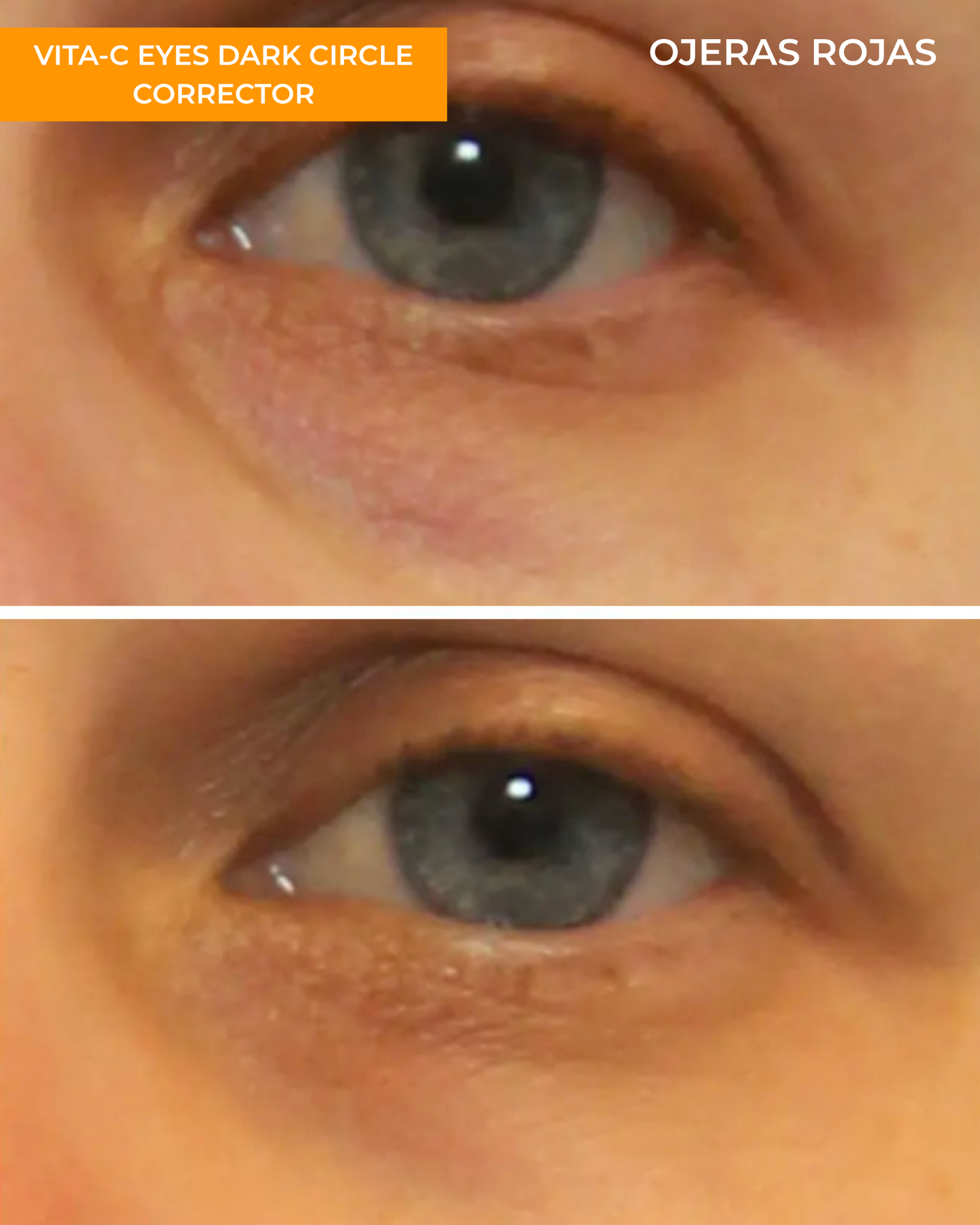 Vita-C Eyes Dark Circle Corrector